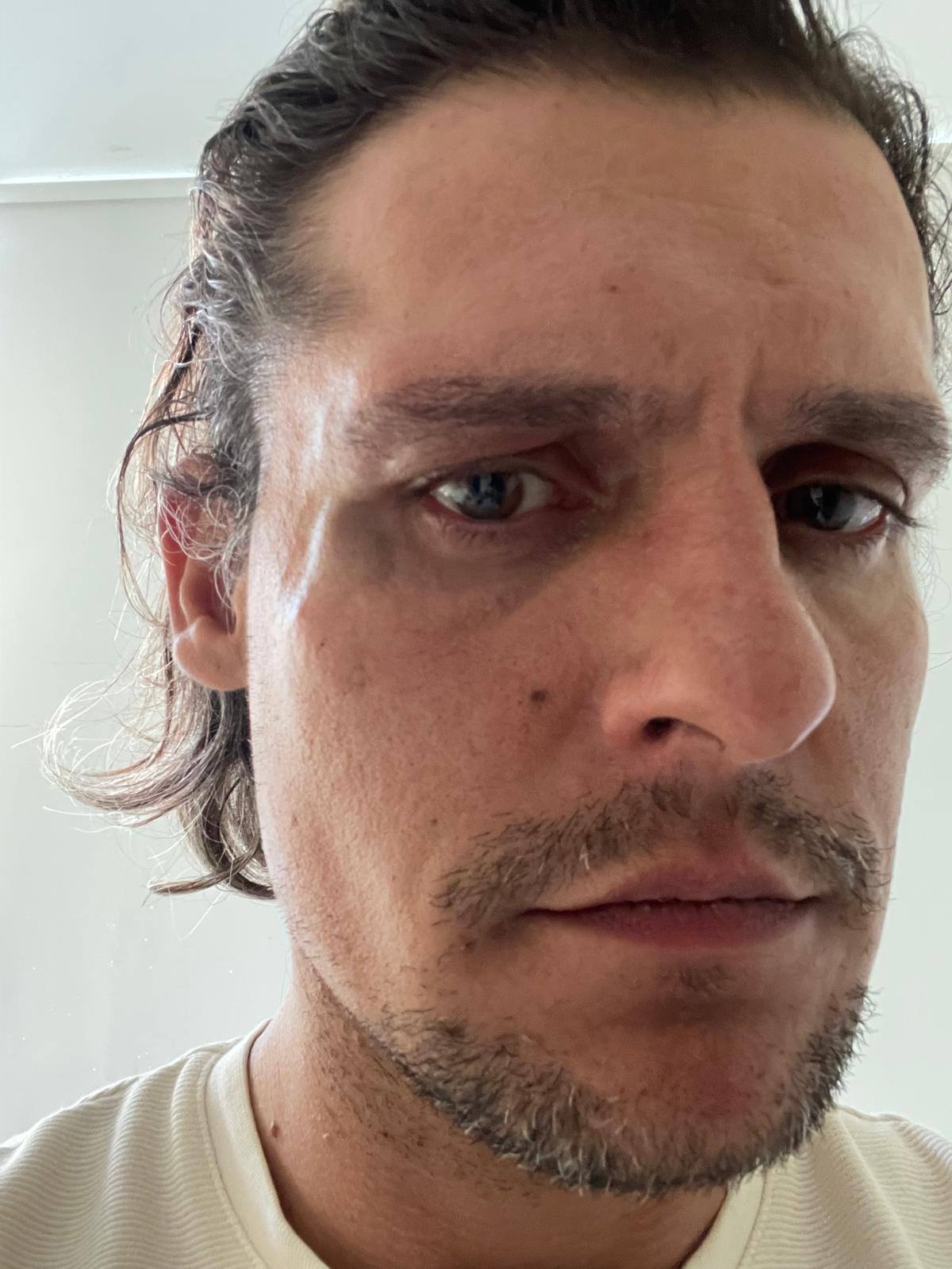 “És tu o violador?”. Ator Carloto Cotta agredido e insultado depois de acusações de sequestro e violação