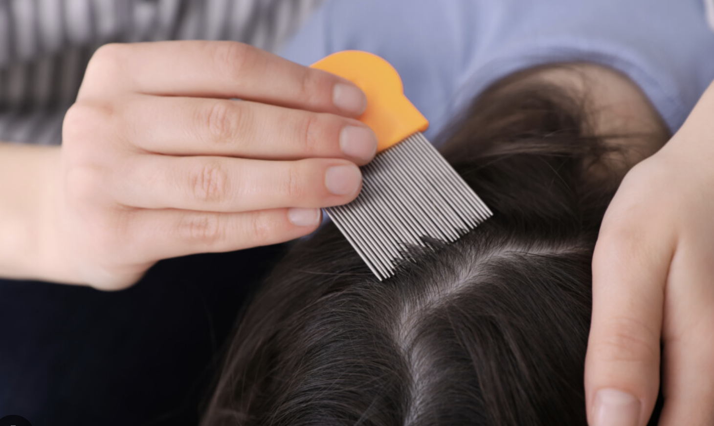 Mãe vegana recusa-se a tirar os piolhos à filha de 7 anos porque não quer “matar seres vivos”