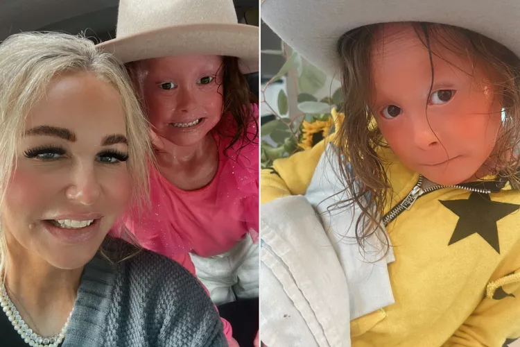 Esta menina de 8 anos tem uma doença de pele incurável que a faz ter de tomar banhos a cada 3 horas por dia