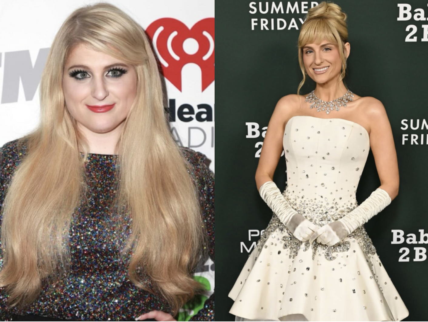Meghan Trainor perdeu quase 30 quilos após ser diagnosticada com diabetes gestacional. Veja o antes e depois