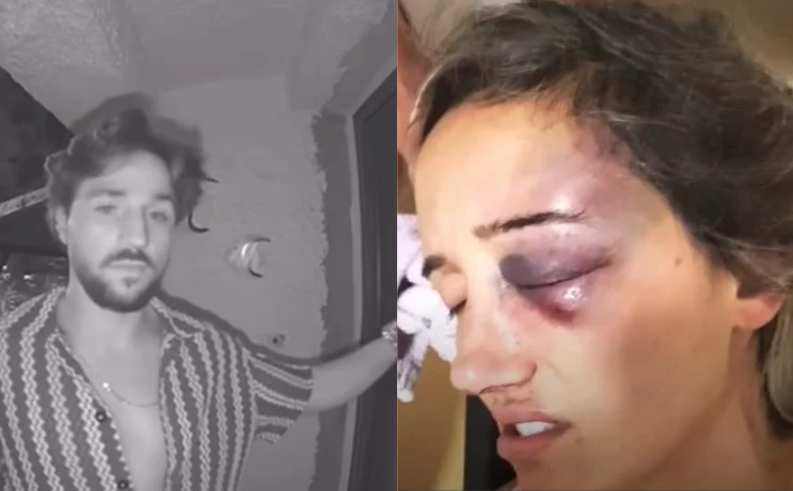 Mulher agredida por bombeiro de Machico poderá ficar cega. Homem está em prisão preventiva