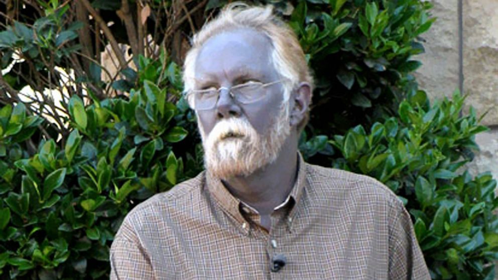 Insólito. A história do homem que ficou azul depois de automedicar-se durante anos