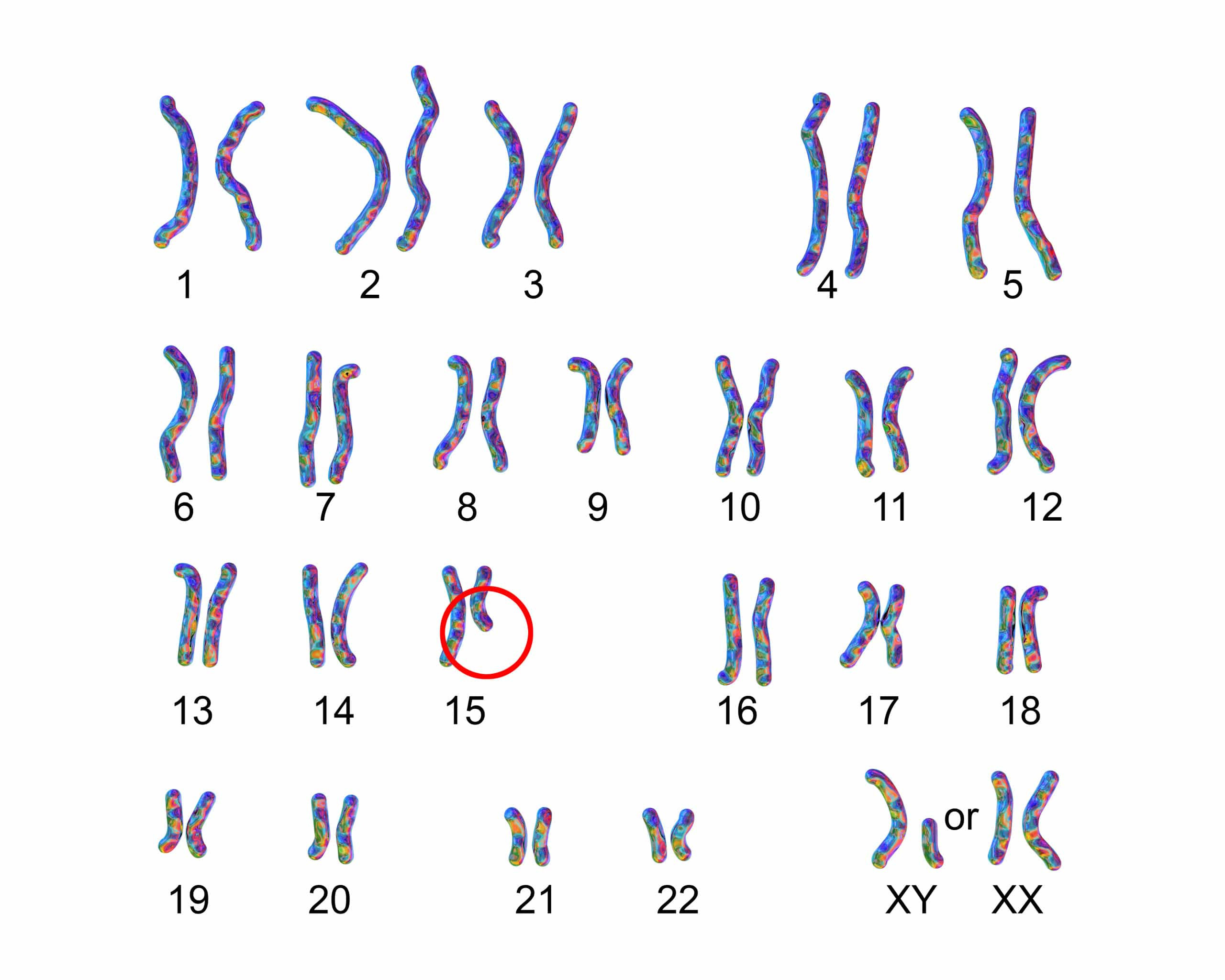 Хромосомы кошки. Karyotype disease.