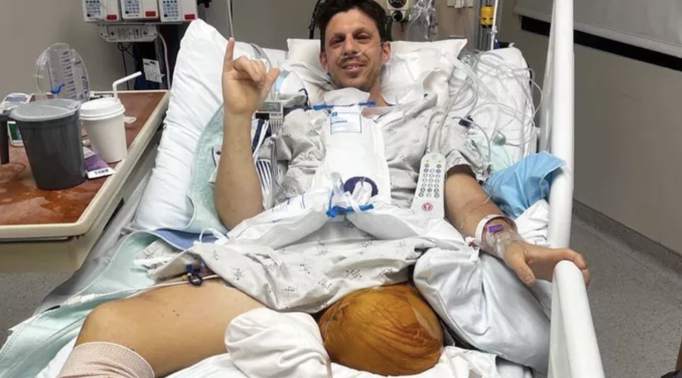 Pai atira-se para a frente de limpa-neves para salvar a família. Acabou com as duas pernas amputadas