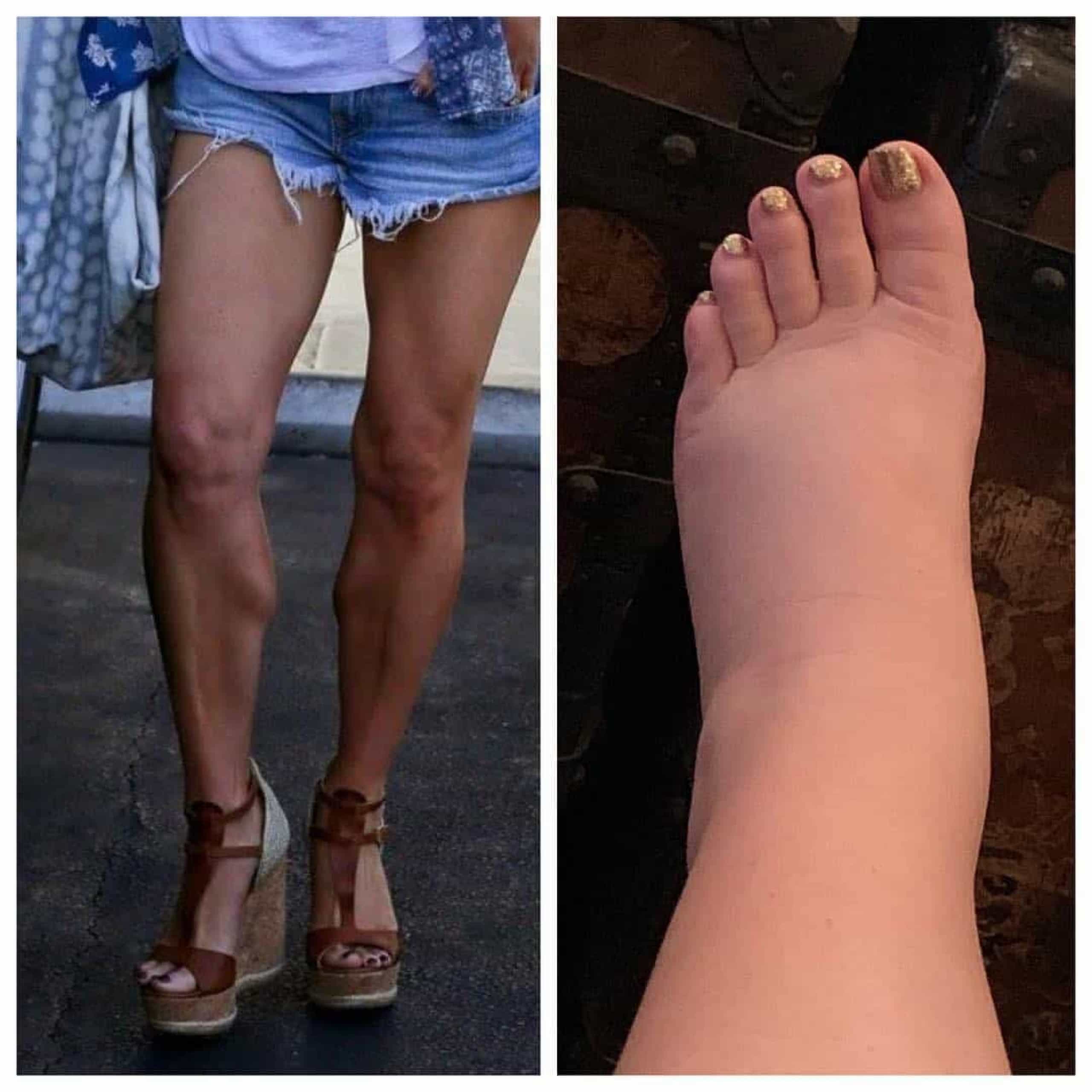 Jessica Simpson impressiona ao mostrar pernas antes e depois de