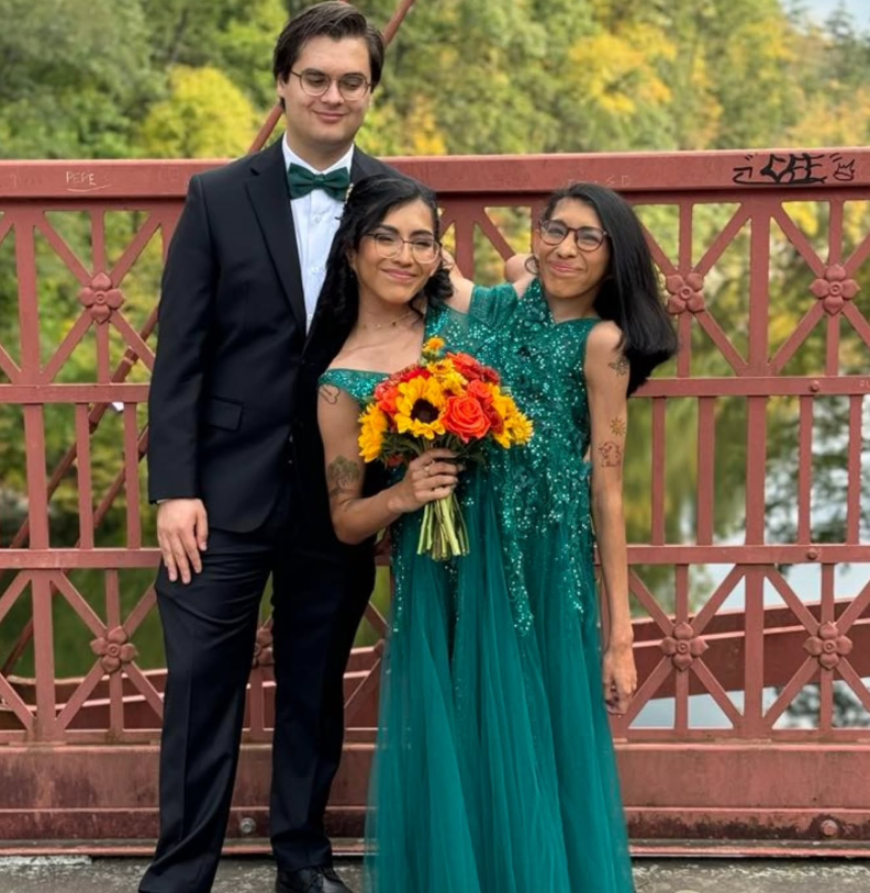 Gémea siamesa de 24 anos casou com namorado de longa data. Irmãs estão ligadas do peito até à pélvis