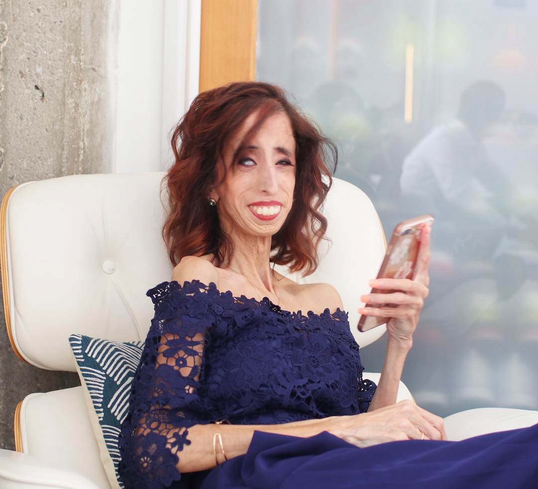 Facetime Prank: Ativista com doença rara alerta para tendência vergonhosa no TikTok