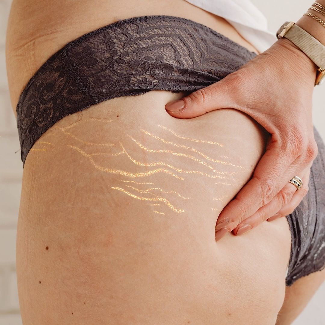 As temperaturas aumentam e as inseguranças também? Não se deixe vencer pela pressão de uma pele perfeita