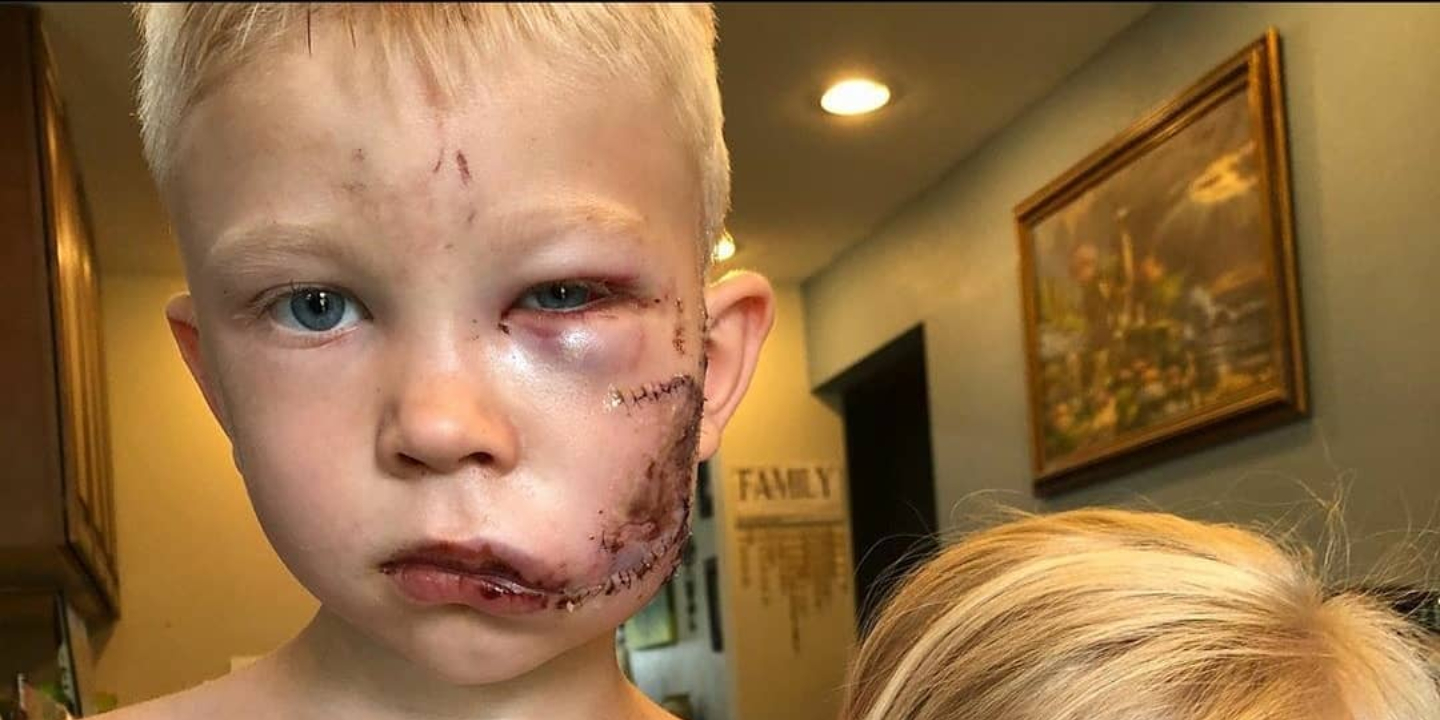 Criança de 6 anos salva irmã de ataque de cão: “Achei que se alguém tivesse de morrer, deveria ser eu”