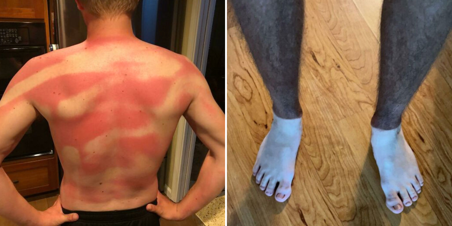 “Quente até queimar”. Estas 50 fotos mostram os mais curiosos (e assustadores) escaldões