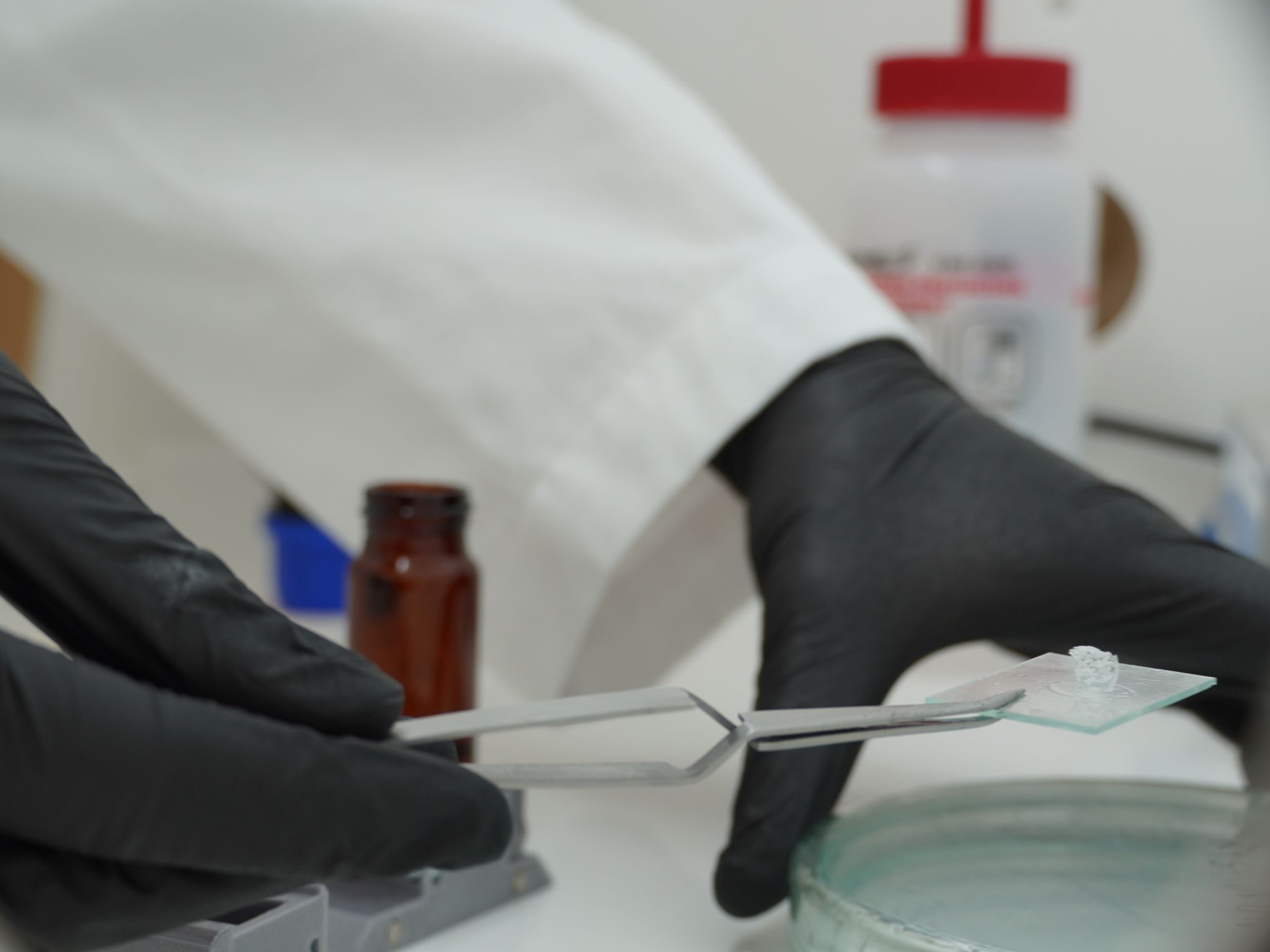 Órgãos impressos em 3D podem ser a resposta para a crescente procura por transplantes de rins