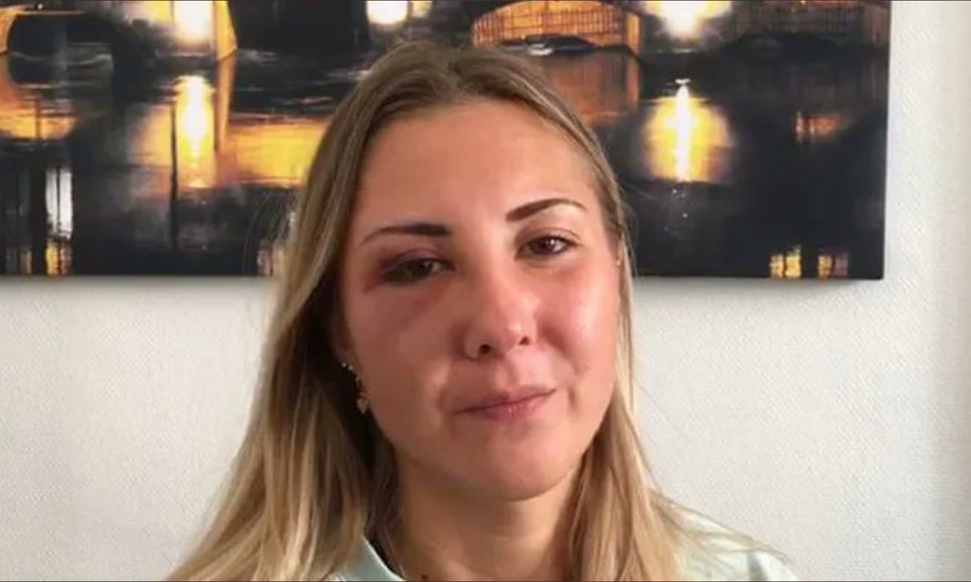 “Olhem para aquela prostituta de saia”. Mulher de 22 anos é atacada na rua por 3 homens