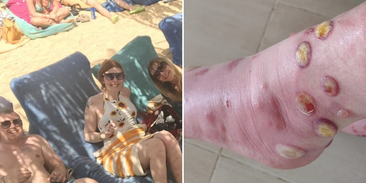 Das picadas de mosquito ao hotel duvidoso, esta família teve umas férias dos infernos. “Absolutamente diabólico”
