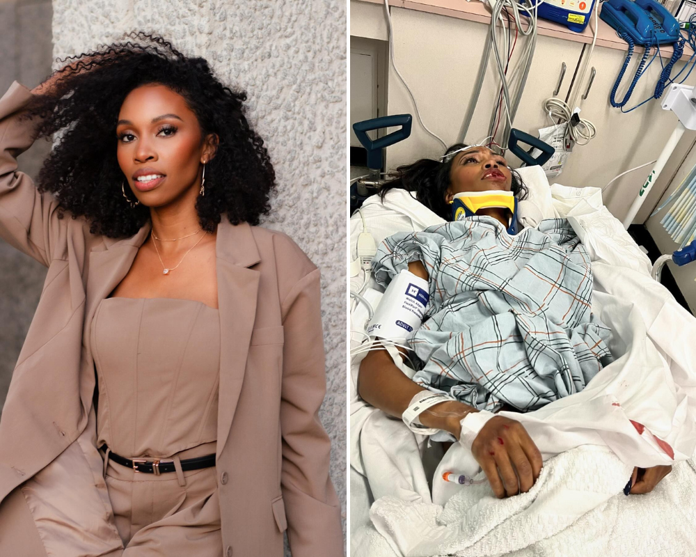 Atriz da Marvel foi atropelada e ficou completamente desfigurada. Veja o vídeo e as fotos