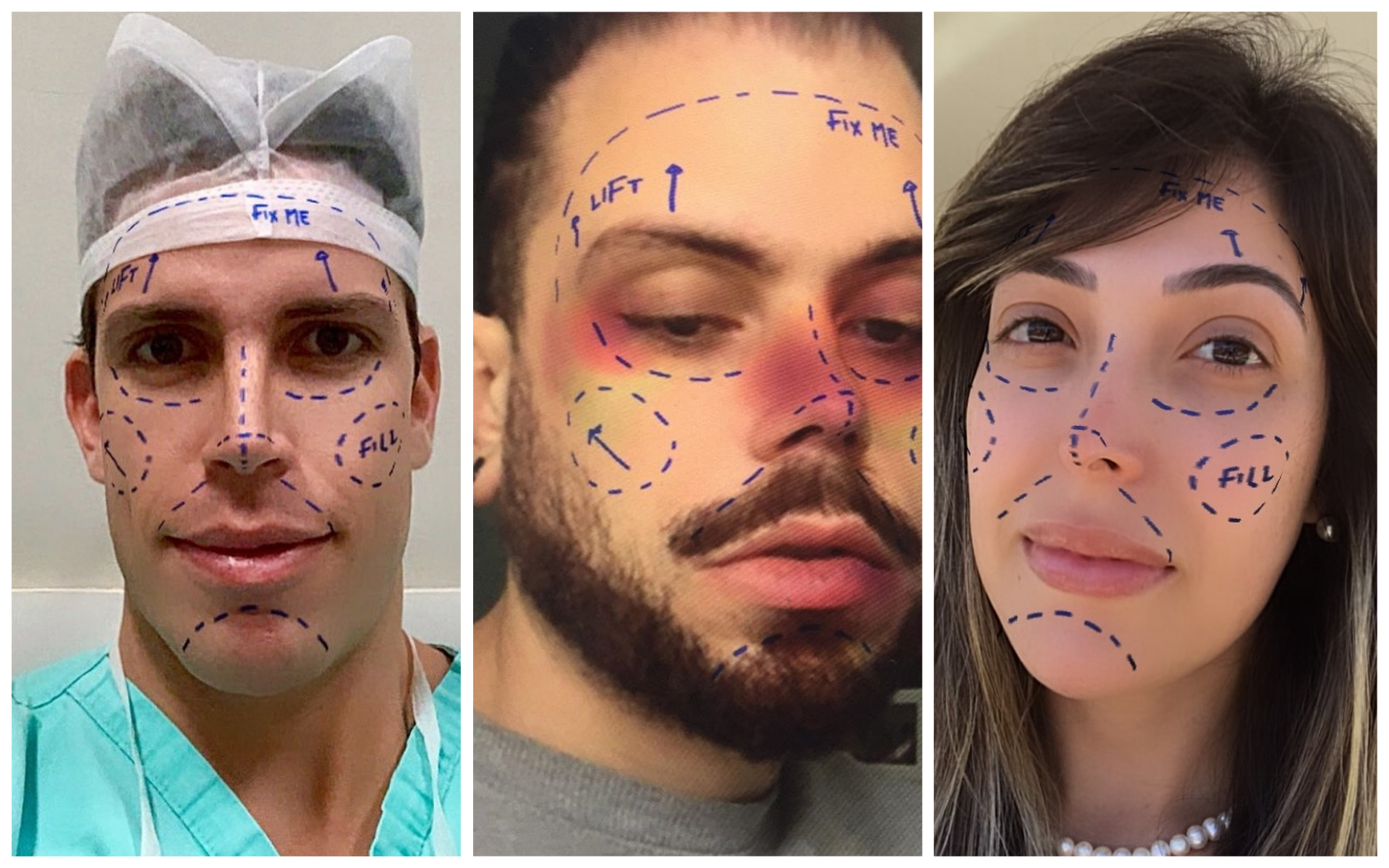 Filtros com efeito de plástica facial vão desaparecer do Instagram