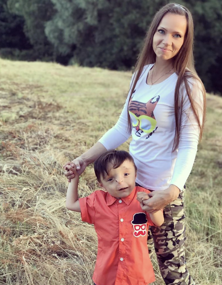 Mulher adota criança rejeitada por causa da aparência e quer provar que o menino não é uma “aberração”