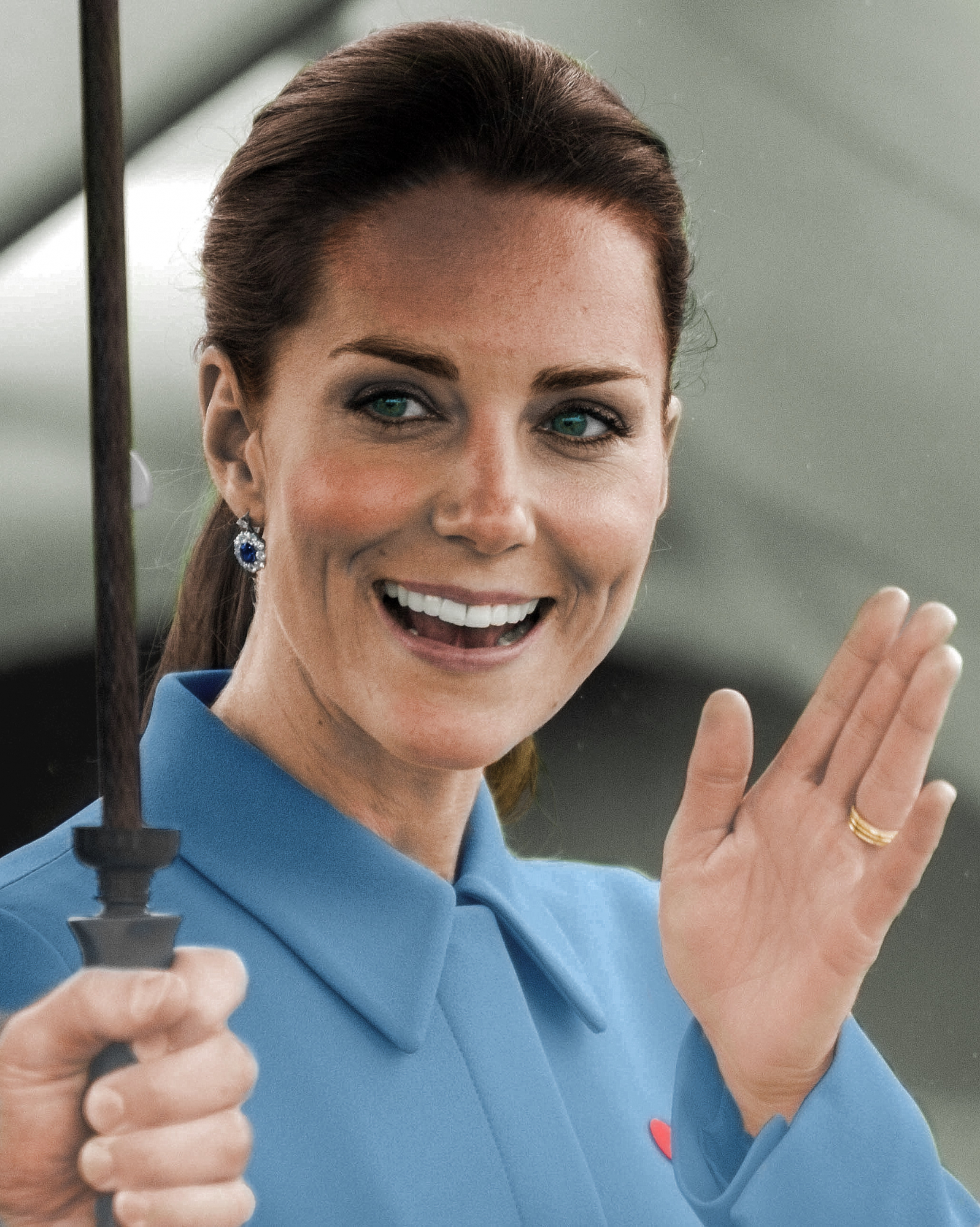 Hiperémese gravídica: a doença que afetou Amy Schumer e Kate Middleton