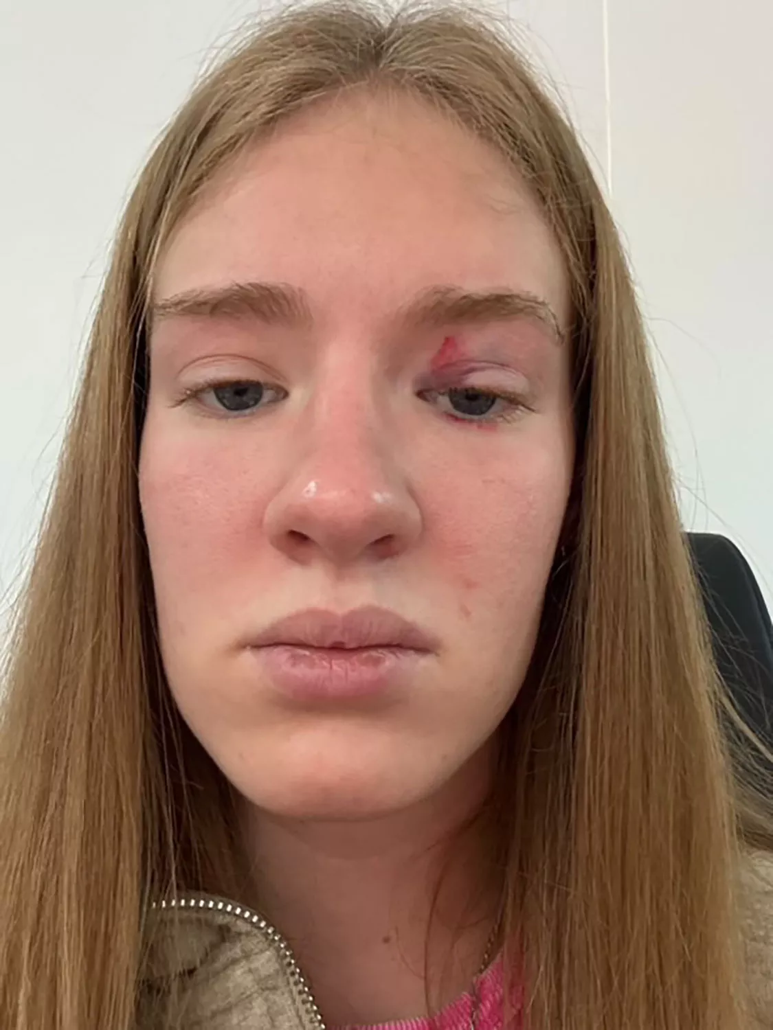 “Sereia” é atacada por peixe gigante e fica com a cabeça presa durante atuação. Veja o vídeo