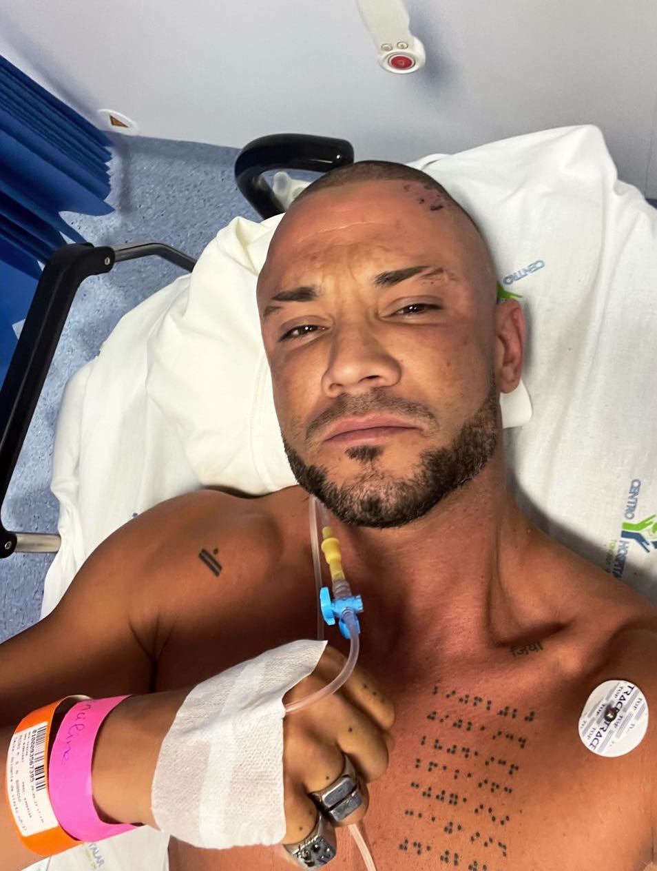 Pedro Barroso teve acidente. “O embate com a cabeça foi grande, o que fez com que perdesse os sentidos”