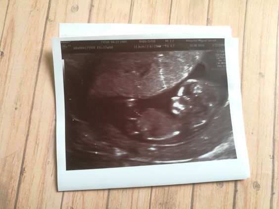 Polícia encontra feto de 20 semanas no sistema de águas residuais no Algarve