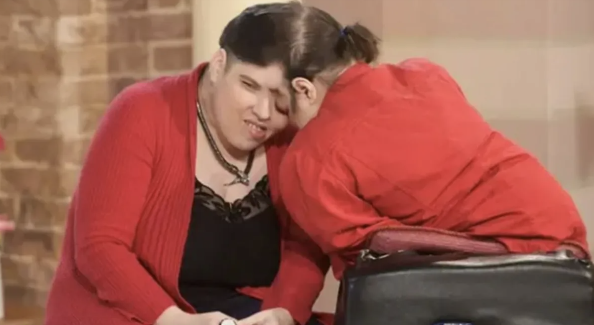 Morreram os gémeos siameses mais velhos do mundo. Lori e George Schappel tinham 62 anos