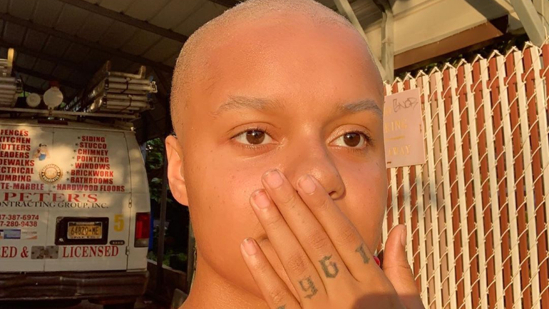 Influencer fica careca depois de misturar químicos para o cabelo