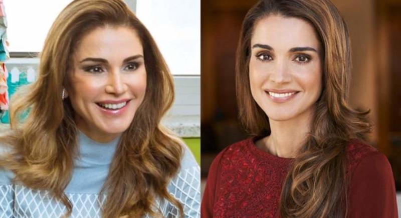 Cirurgia plástica. O antes e o depois das famosas