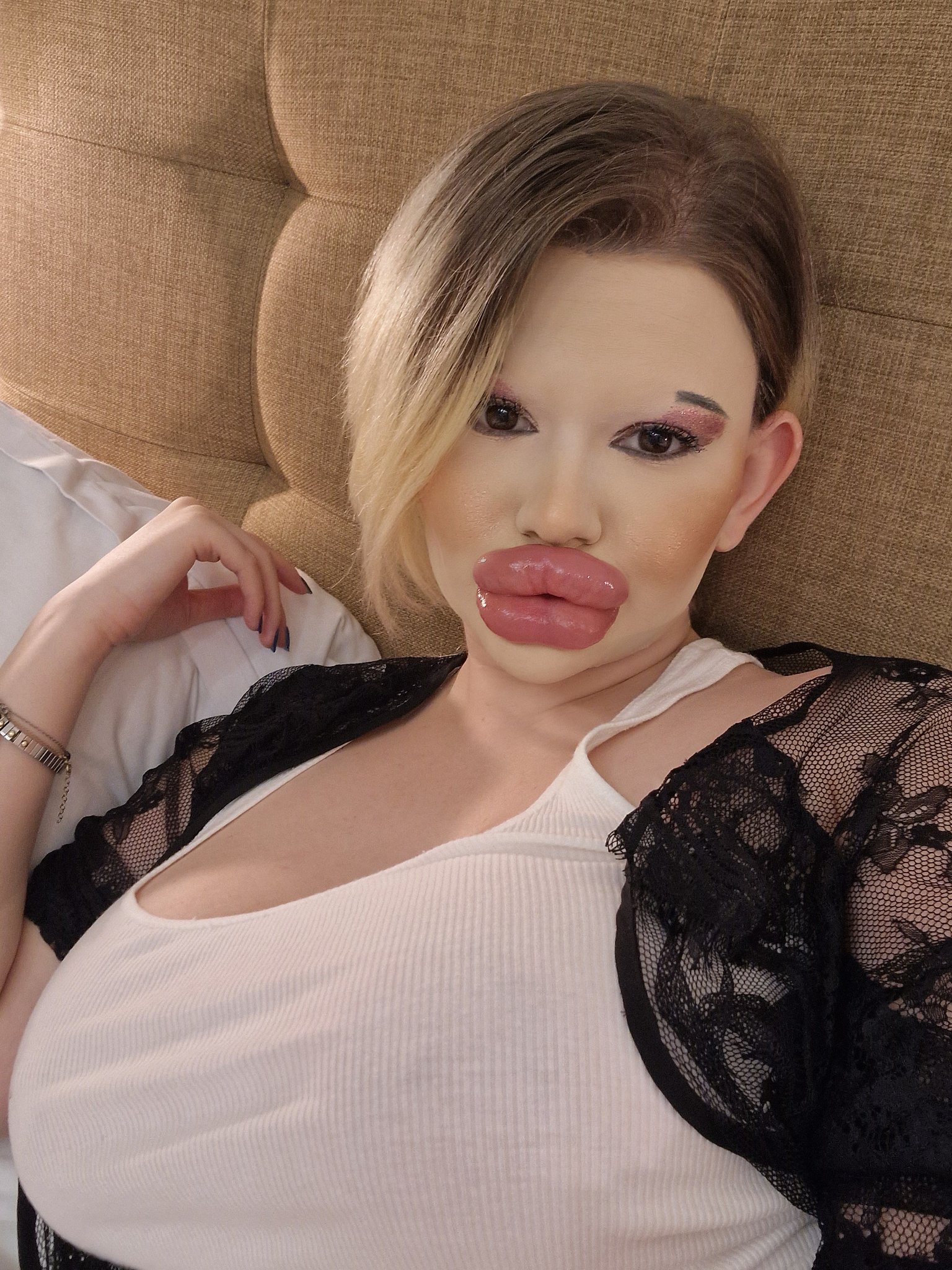 Mulher de 24 anos já injetou os lábios mais de 30 vezes. Objetivo? Tornar-se a “Barbie humana”