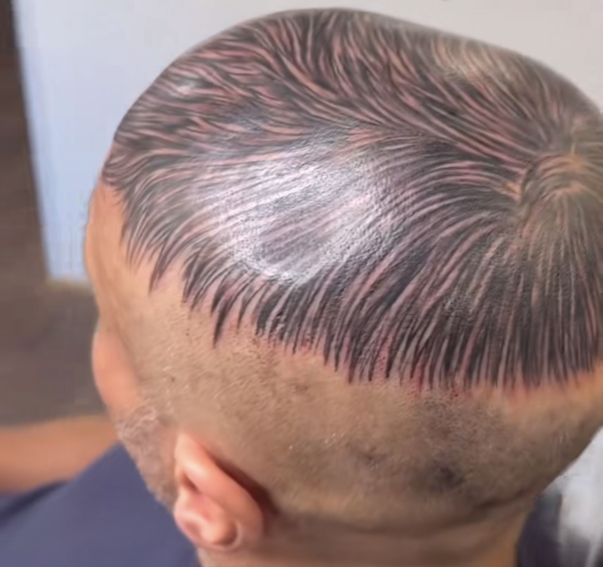 Homem careca tatua cabelo e vídeo fica viral — e diz adeus aos transplantes capilares