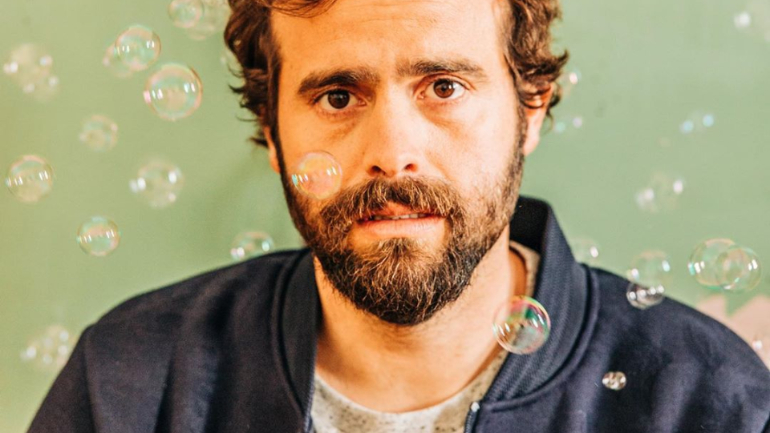 Afinal Manzarra não rapou o cabelo e também não usou photoshop. O truque foi outro