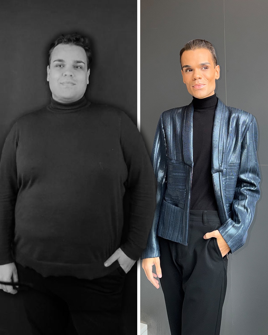 De “obeso mórbido” a ganhar “muito mais autoestima”.  Zé Lopes fala sobre incrível jornada de perda de peso