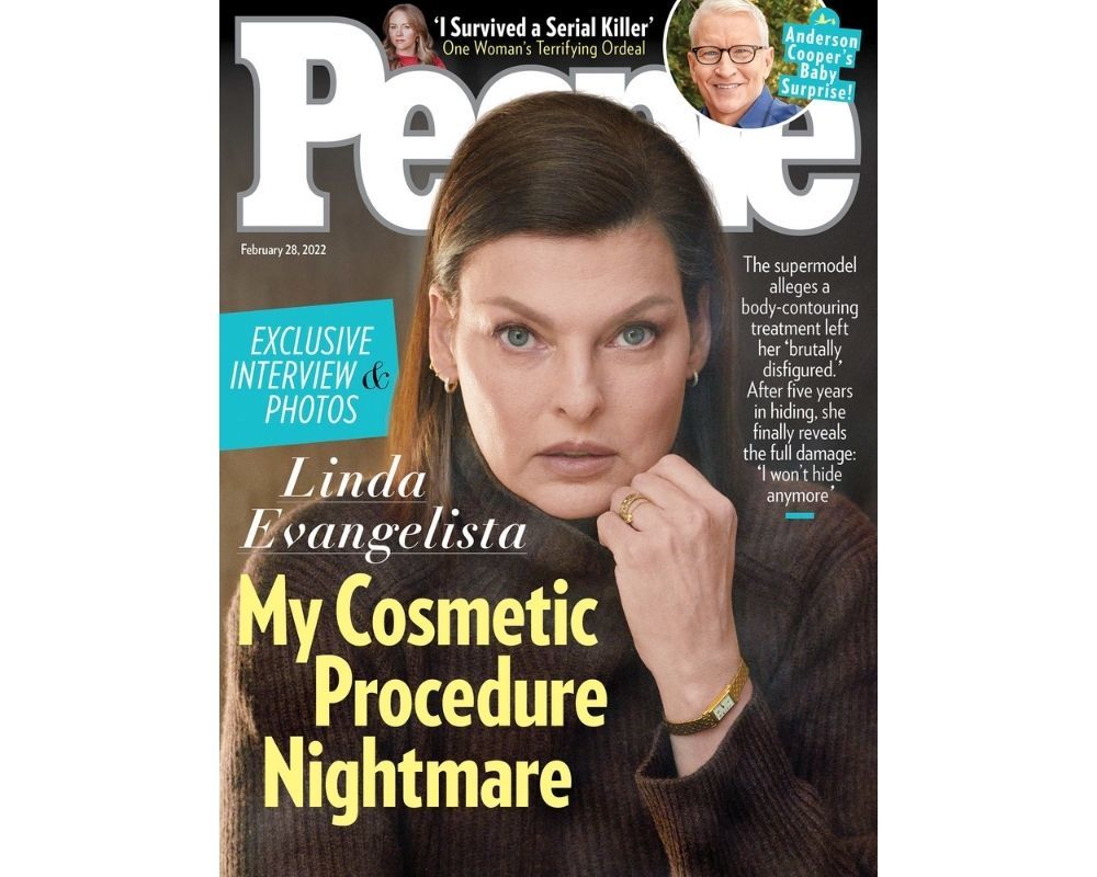 Linda Evangelista sobre tratamento que a deixou desfigurada. “Achei que estava a enlouquecer”