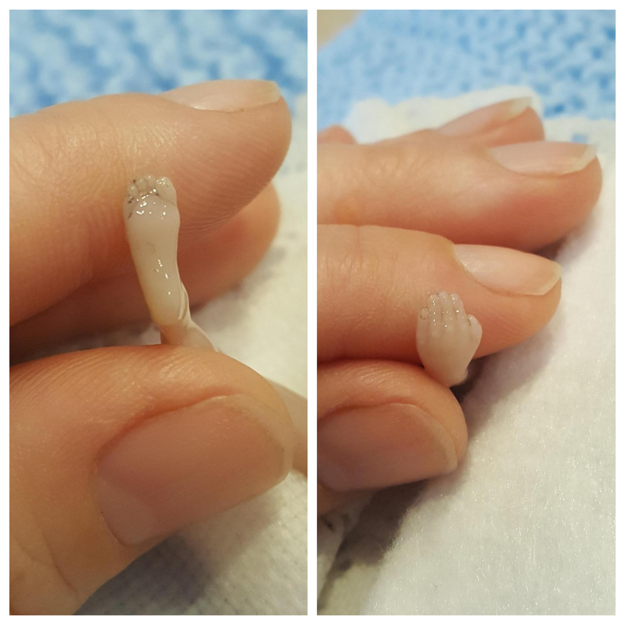 Mãe mostra feto de 14 semanas morto depois de o hospital o declarar “lixo médico”