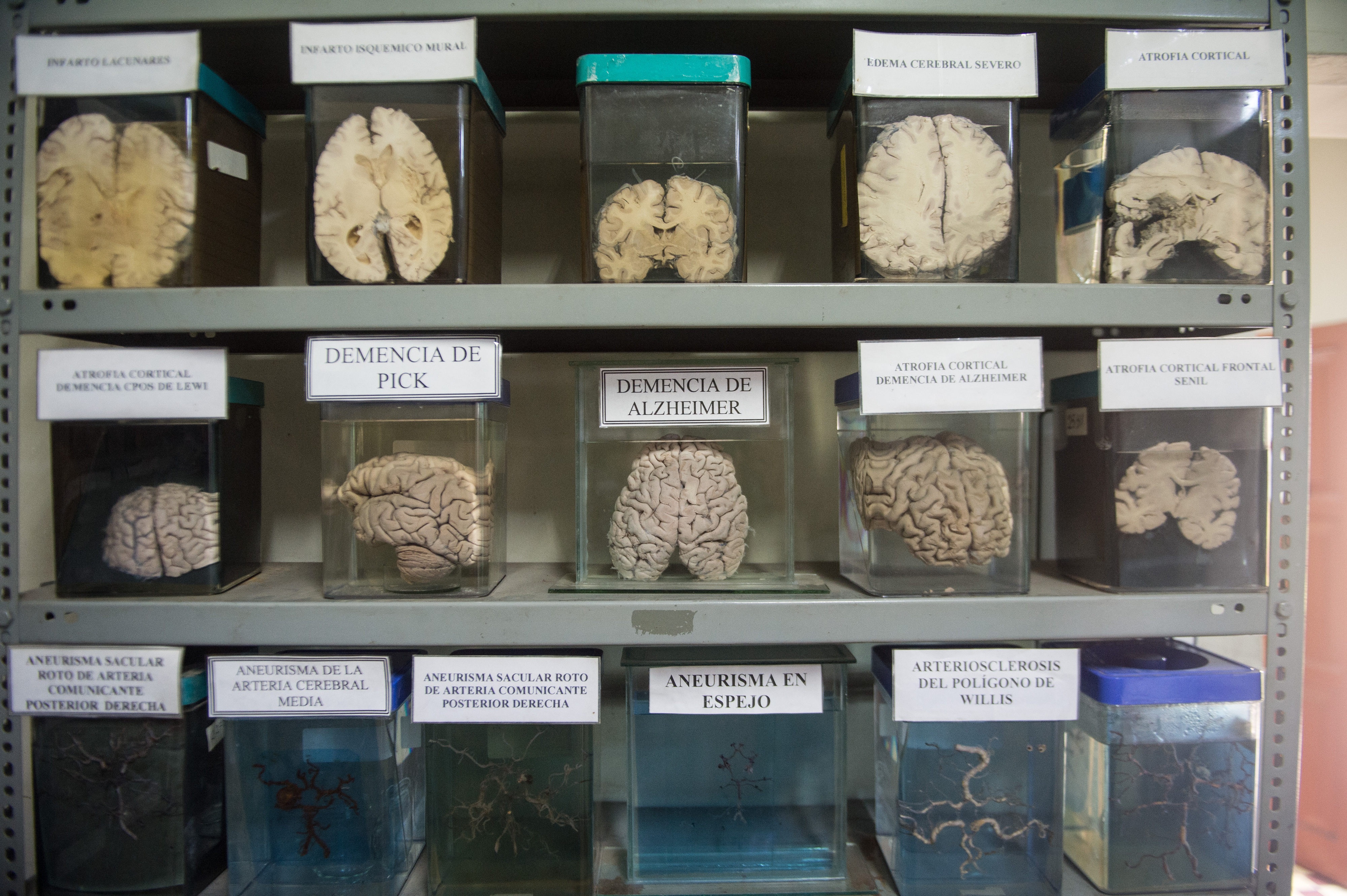 Descoberta nova estrutura no cérebro humano - Atualidade - SAPO Lifestyle