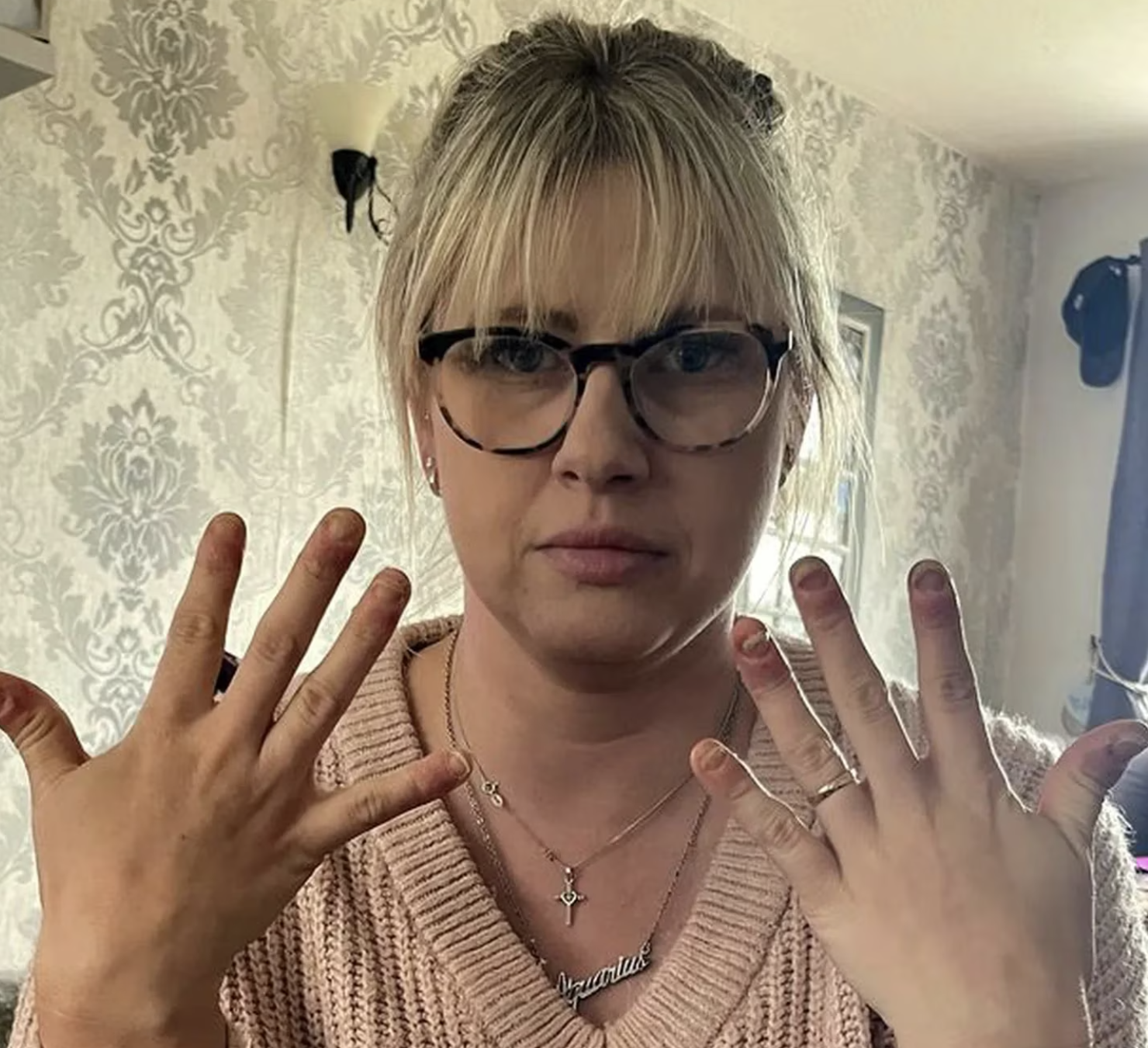 Nem vai acreditar em como ficaram as mãos desta mulher depois de uma ida à manicure para tratar das unhas