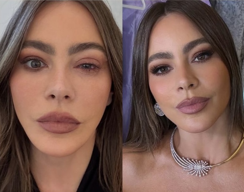 Sofia Vergara foi parar ao hospital momentos antes dos Emmys. Atriz teve uma reação alérgica severa