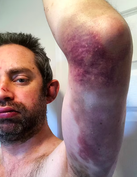 Cuspo na cara, violência e controlo até da sanita que podia usar. Este homem foi vítima de violência doméstica durante 20 anos