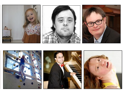 Porque é que às vezes sentimos picadas no peito?