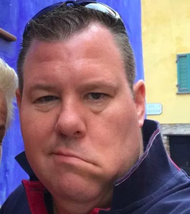 Este homem deixou de conseguir sorrir devido a um tumor. Cirurgia inovadora mudou tudo (veja a diferença)