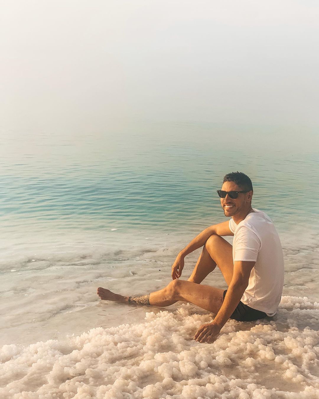 Ângelo Rodrigues mostra cicatriz pela primeira vez