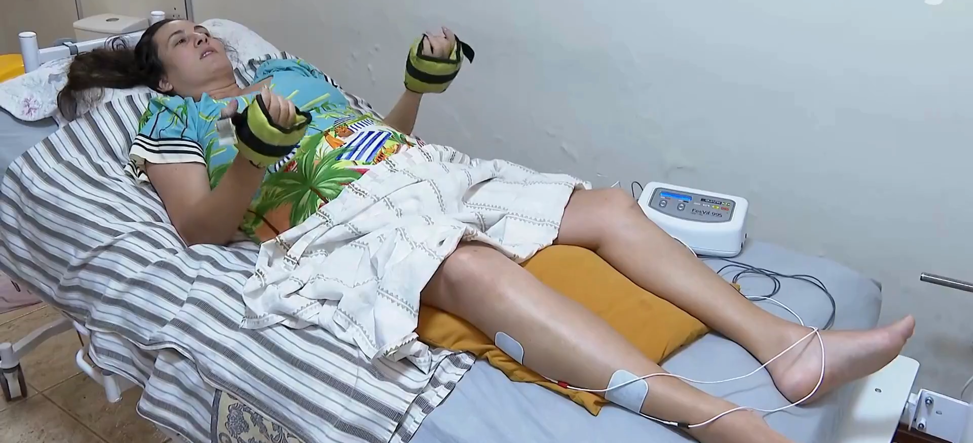 Turista cai de varanda de Airbnb depois de deck da piscina ceder. Lesionou a medula e partiu 8 costelas