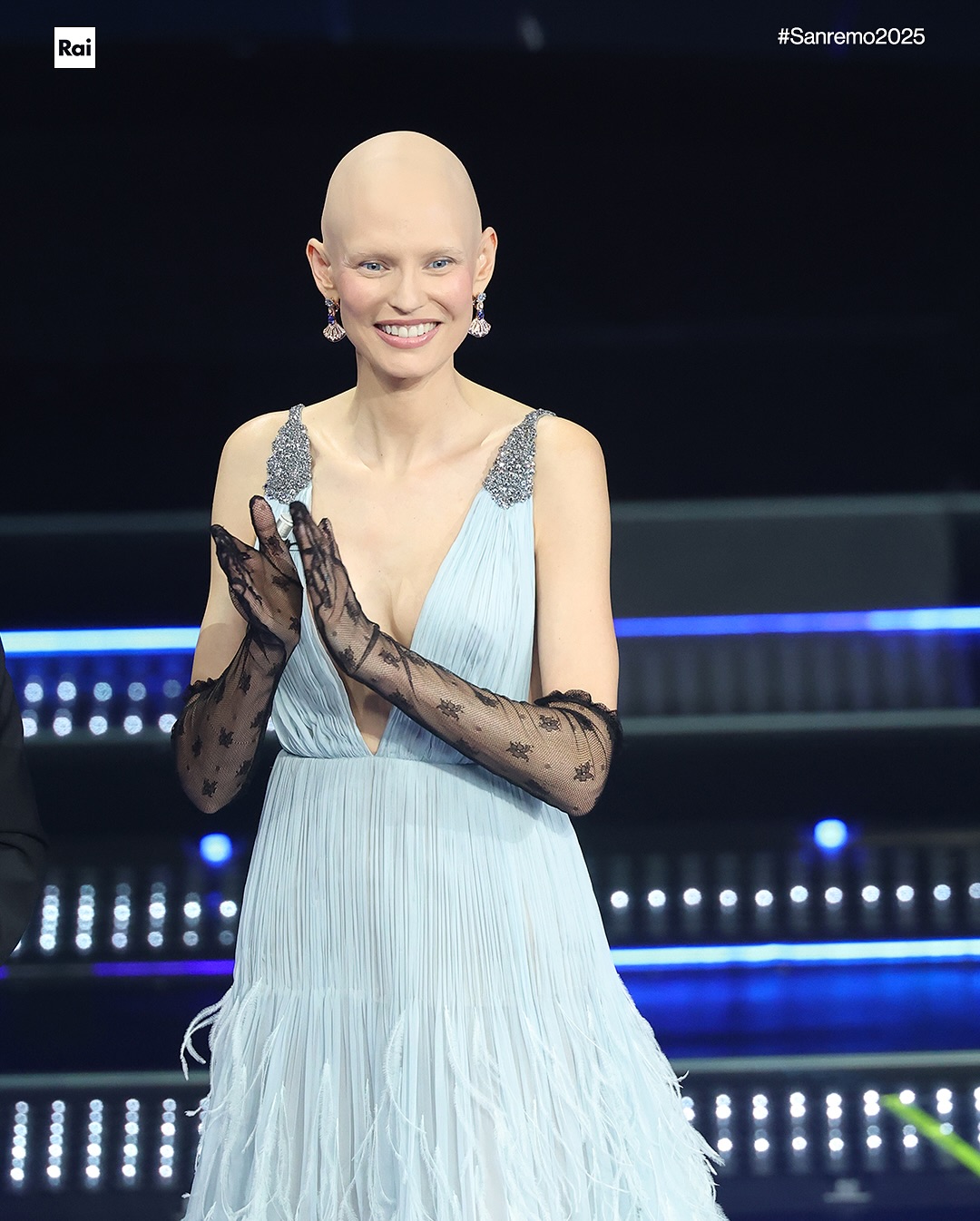 Com cancro, modelo Bianca Balti emociona Itália ao surgir careca no Festival de Sanremo
