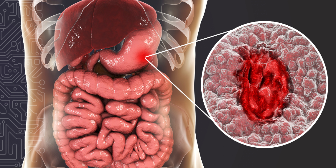 Normas para uso de IA em endoscopia e diagnóstico de cancro com contributo português