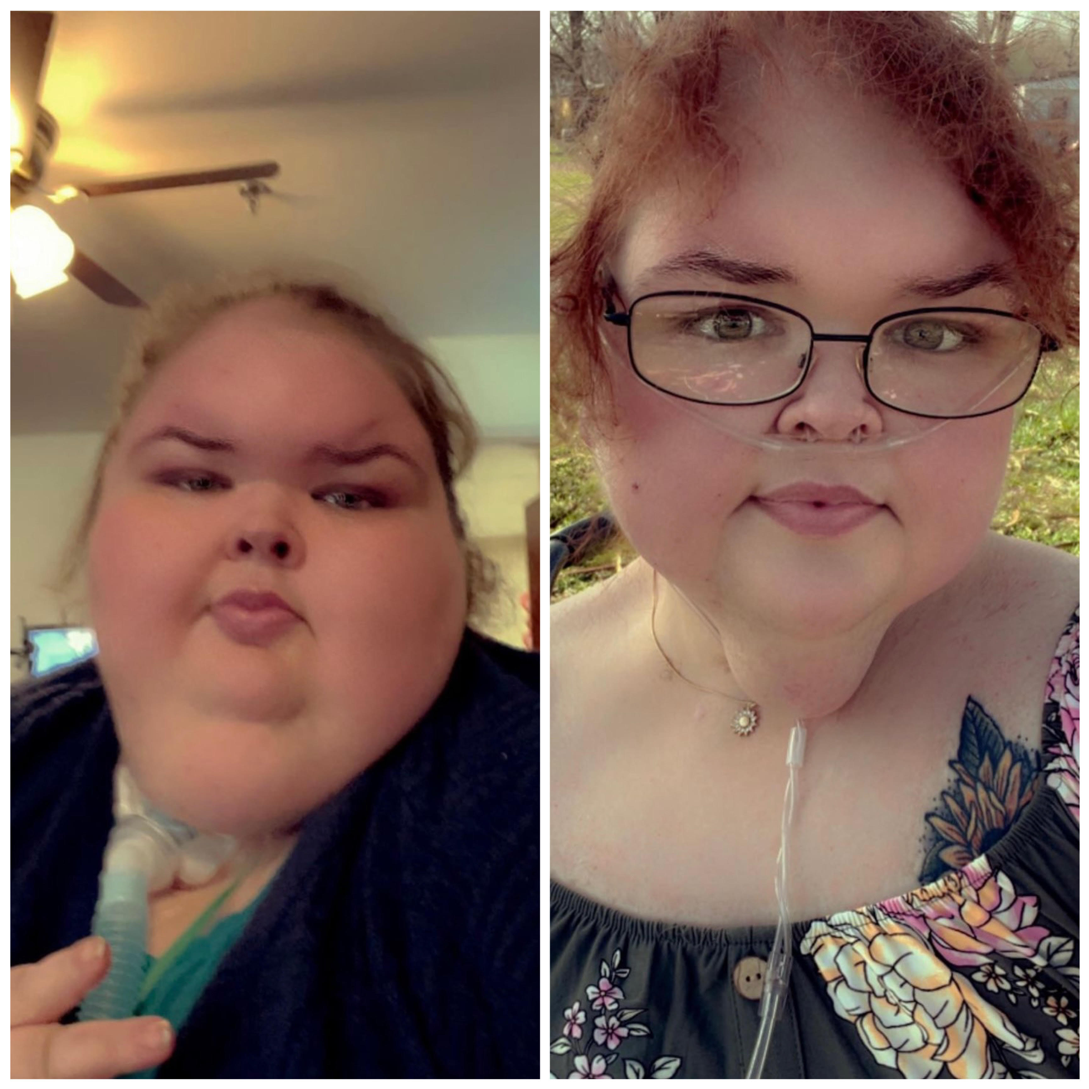 Estrela de reality show mostra perda de peso drástica. Tammy chegou a pesar 325 quilos