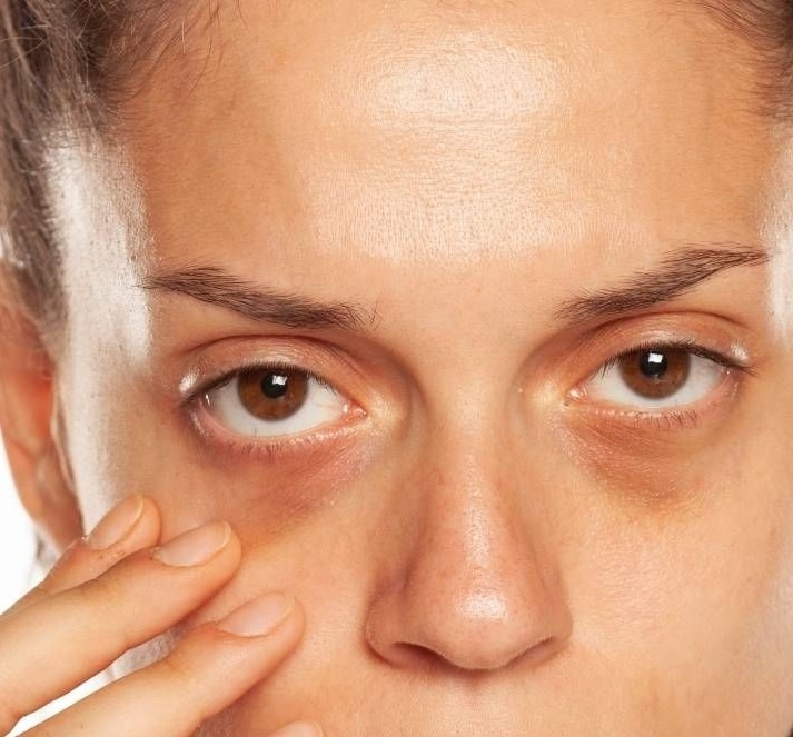 Ficou com olheiras graças à noite de eleições? 12 corretores que prometem escondê-las em três tempos