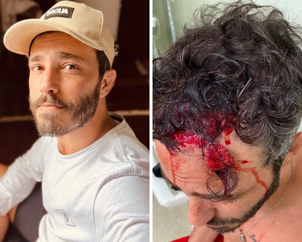 Ator da novela da TVI “Quero É Viver” assaltado e espancado no Rio de Janeiro