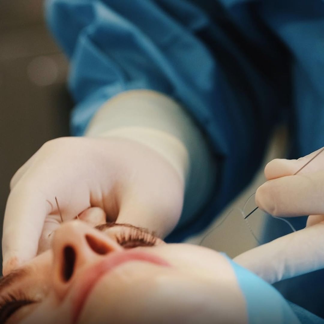 De que forma se pode mudar o rosto sem ir à faca? Falámos com um cirurgião plástico