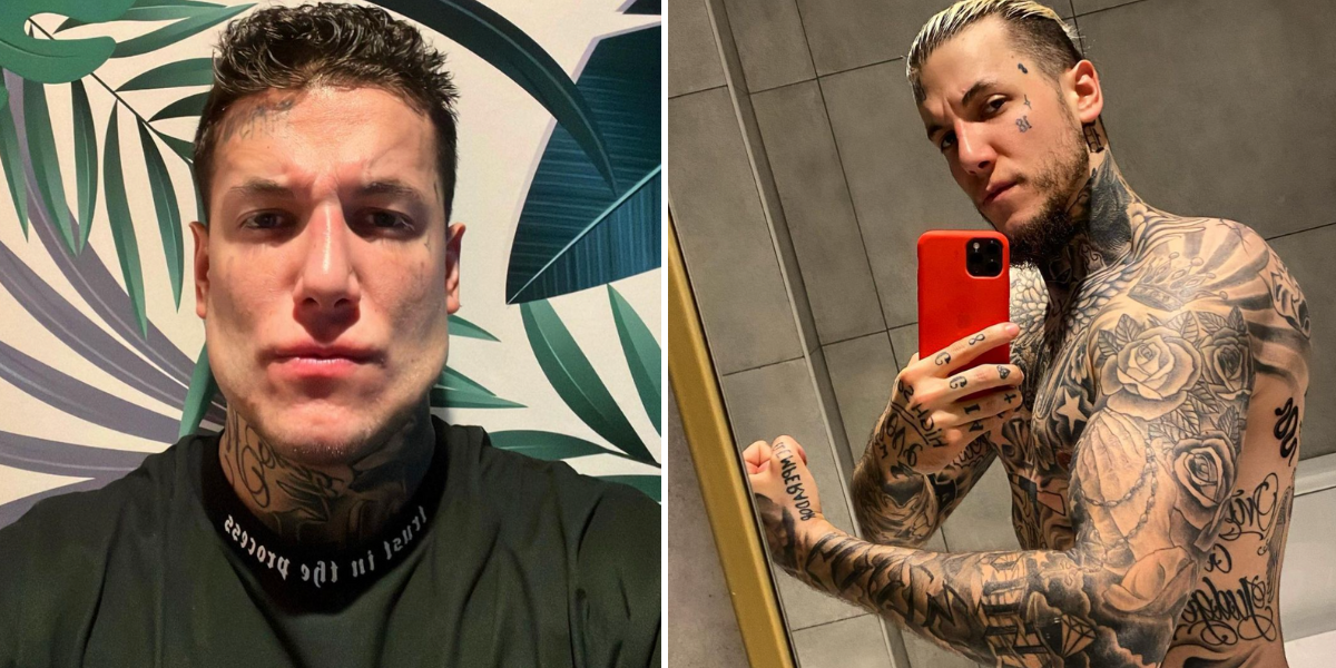 Filho de antigo craque do Benfica faz plástica polémica ao queixo e deixa os fãs em choque