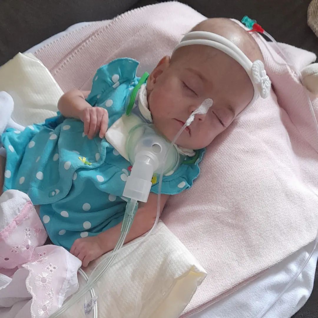 Bebé prematura que nasceu com 580 gramas teve de passar por 12 cirurgias para ter alta