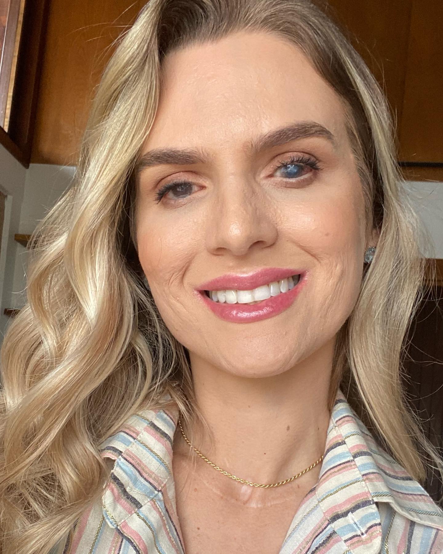 Mulher tomou medicamento para dores menstruais, ficou em coma e perdeu 60% da visão